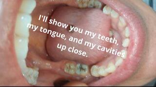 I'll show you my teeth, my tongue, and my cavities up close.