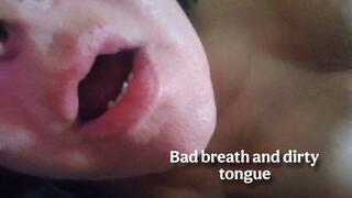 Bad breath and dirty tongue 2