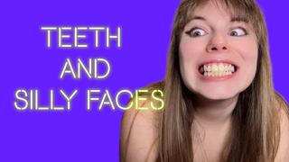 Showing you my mouth and teeth while doing silly faces