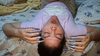 Severe cough with intense reversed gag reflex