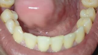 Look at my mouth and my teeth.