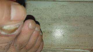 My feet and my nails are super awful