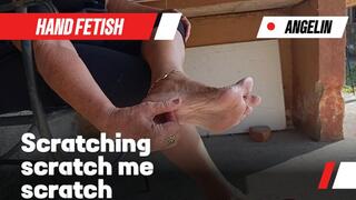 Desperate scratching her feet (1)