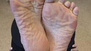 Up Close With My Wrinkled Soles