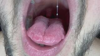 Uvula and Torn Tongue are extremely close