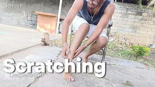 A man scratching his feet because of great itching (6)