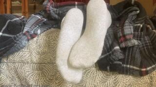 Life with Athlete's Foot - No Rest for the Itchy