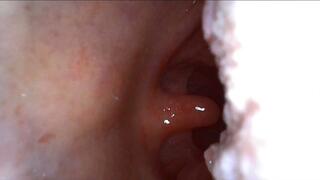 Sloanes Endoscopic Mouth Tour