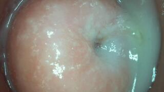 Creamy cervix