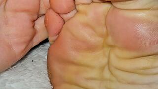 Interesting pattern on my shiny soles