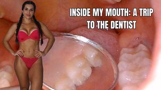 Inside my mouth: a trip to the dentist - OnlyVanessa