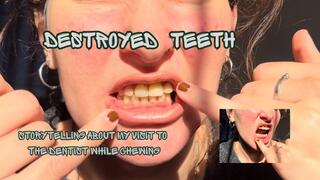 Storytelling about my visit to the dentist while chewing