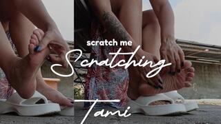 She is scratching her feet because it is itchy (4)