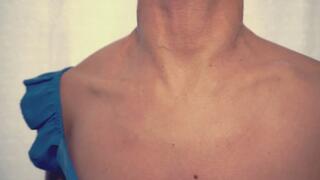 Veiny Neck & Female Adam’s Apple