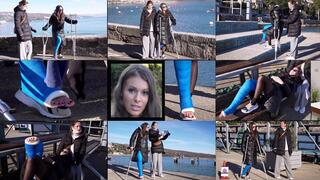 Lia LLC Crutching Down by Pier in a Very Angled Cast With and Without Cast Sock