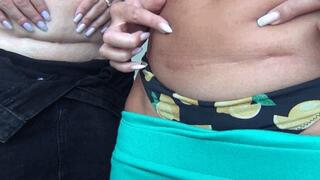 A SCAR ON A FAT BELLY (f)