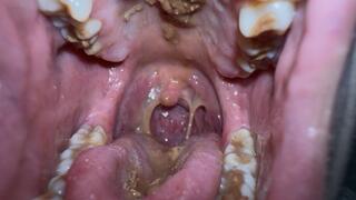 Eating chocolate Close-Up Inside My Mouth - Uvula Full View