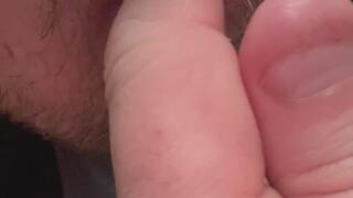 Short bitten nails