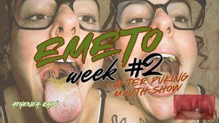 Rough Throw Up & Aftermath — Messy Emeto Mouth POV