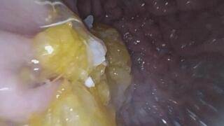 Endoscopic Exploration of a Mandarin Orange (part 2)