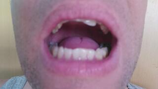 I show you my mouth and uvula with spit