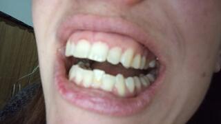 My teeth and molars