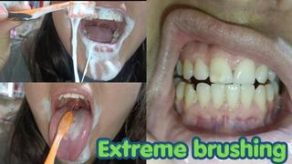 Extreme brushing, 2 days without cleaning