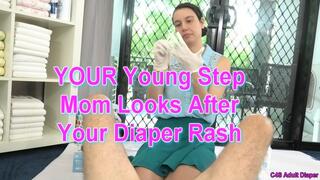 YOUR Young Step Mom Looks After Your Diaper Rash