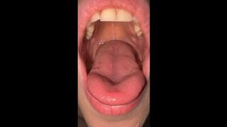 I'll show you the inside of my mouth
