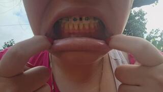 Opening her mouth to show her teeth