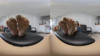 3DVR180 ERER shows its wrinkled feet