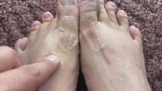 Bob shows off his hairy toes