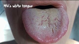 Mia's white tongue