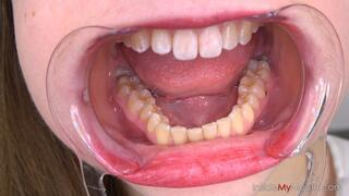 Kate's Intimate Mouth Tour - Extreme Close-Up Tongue, Teeth & Uvula Fetish (MOBILE resolution)