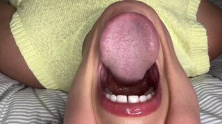 Extremely Nervous Dental Patient Returns | Detailed Mouth Examination POV (Part 2)