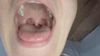 The fat girl shows you the inside of her mouth