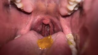 Uvula Close-Up While Chewing Gummybears