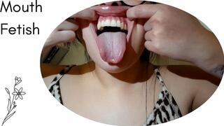 Drooling, an open mouth, and crooked teeth..