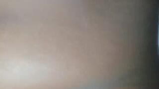 My belly button after labour
