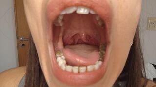 The Charm of the Uvula