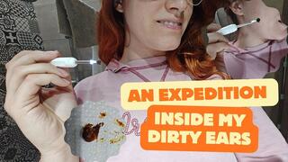 An expedition inside my dirty ears