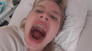 A huge smelly yawn tomorrow! MP4