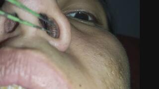 Nostril Inspection With Tweezers – Showing My Nose Hairs
