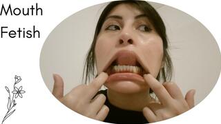 I open my huge mouth for you... drool, crooked teeth, and a wide-open mouth.
