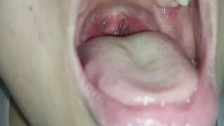 Mis amígdalas inflamadas al descubierto: Lo que nadie quiere mostrar.