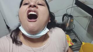 Mis amígdalas en primer plano.