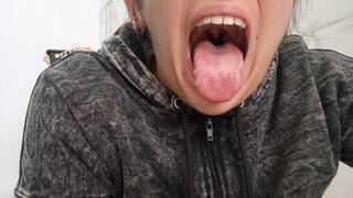 Lola's defective mouth