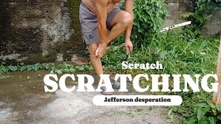 Man scratching his feet due to itching when cutting bush (T)