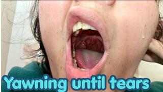 yawned until he cried Close-ups