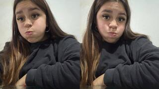 Severe cough + puffy cheeks